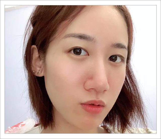 脸上螨虫的正确消灭方法,脸上的螨虫能不能彻底消灭