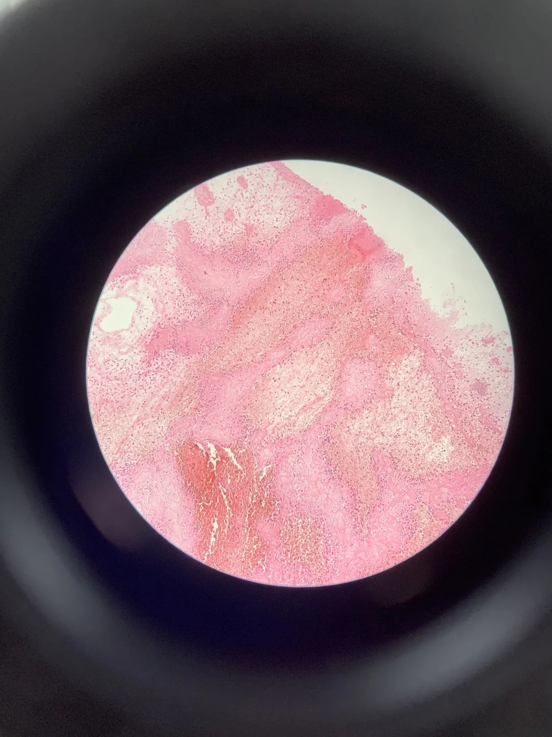 医学生学习打卡做题,医学生学习成果检验视频