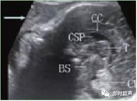 产科常规彩色超声报告单介绍,常见妇科疾病超声报告