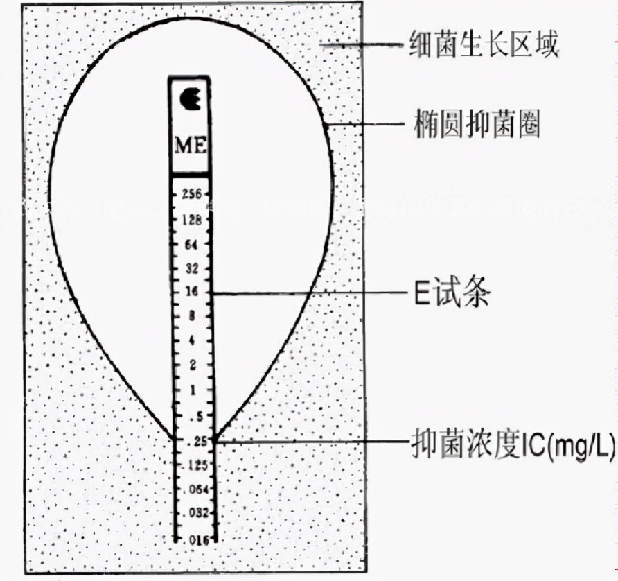 药敏是查什么的,药敏报告是怎么检查