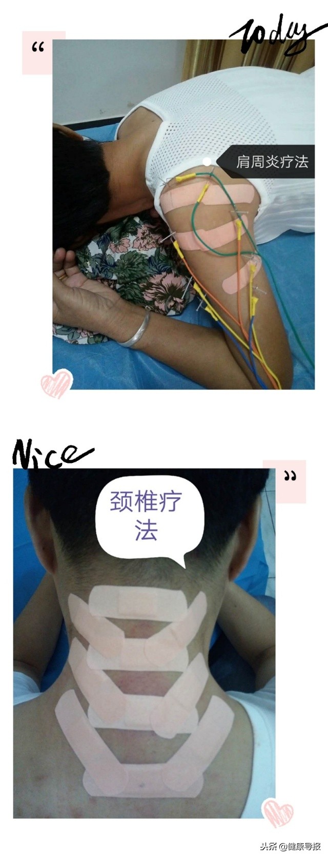 刀随心神走，效从指间出汉滨区南溪卫生院颜学生医生浅谈水针疗法