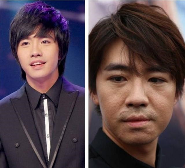 从毁容到重生,从美男子到毁容俞灏明如今怎样了