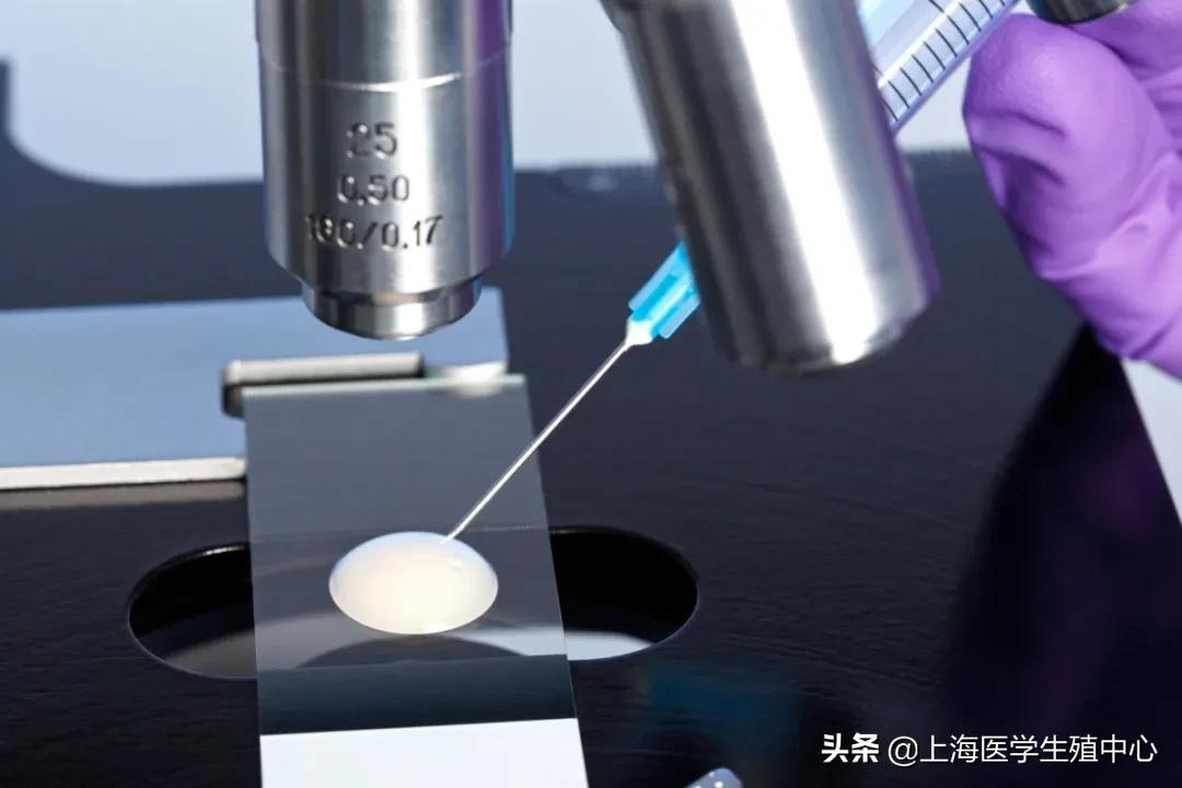 通过精子颜色可以看出精子质量吗,精子质量主要看哪几个指标