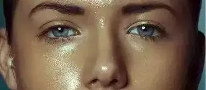 后背长闭合性粉刺怎么办,下巴长闭合性粉刺怎么去除