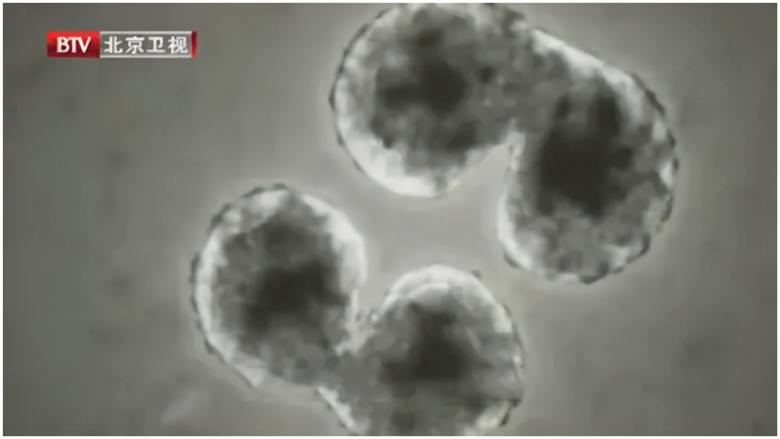 这些炎症可能比癌症更可怕，发病快、致死率高！用好餐桌上的“天然消炎剂”，给身体“消消炎”