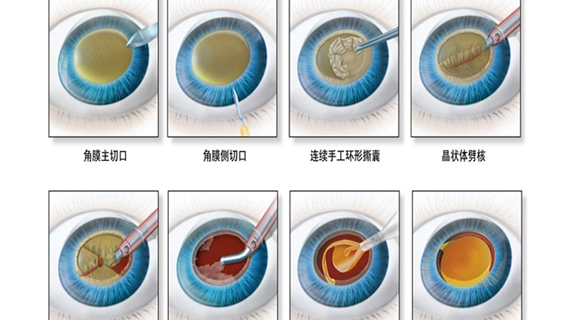 忽然老花很严重因为什么,开始出现老花眼了怎么办