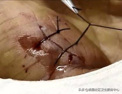 为啥鼠兔咬伤不用打狂犬疫苗,老鼠咬伤要不要打狂犬疫苗