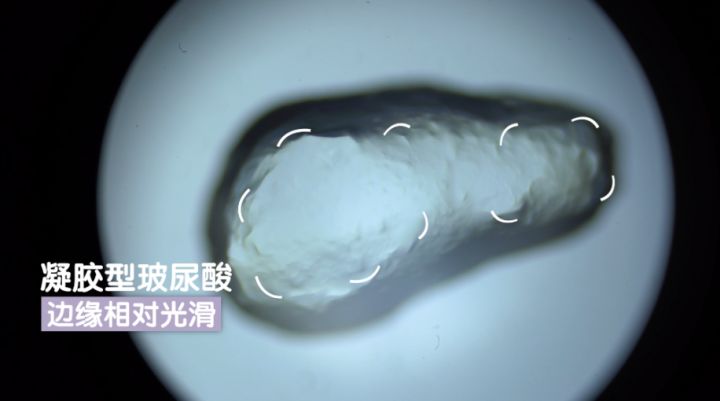 玻尿酸比较好的,好的玻尿酸成分表