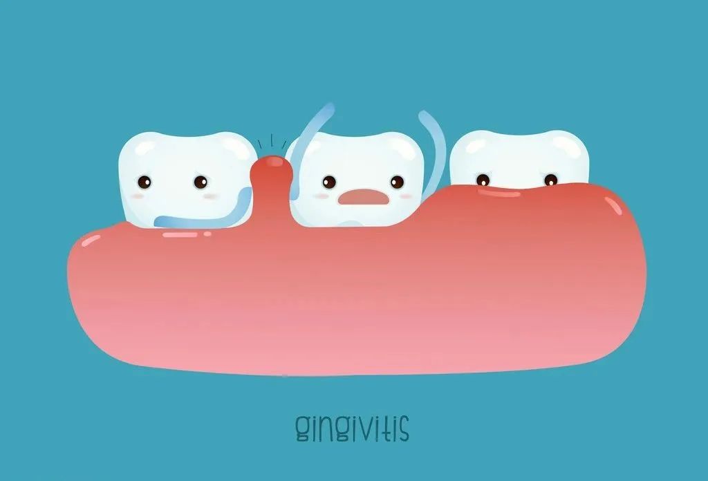 两面针护龈防出血,牙龈肿痛出血有何偏方