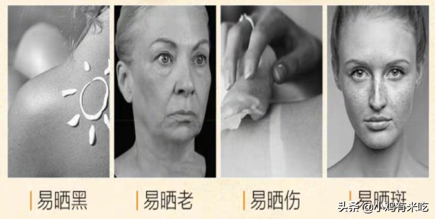 晒后皮肤敏感发红怎样修复,肌肤晒后可以自我修复吗