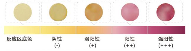 为什么有些人说话要捂嘴,捂着嘴说话的人是什么心理