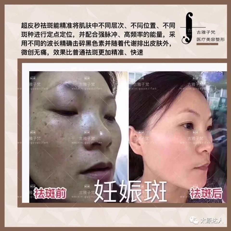814元人气精华护理免费做！一次就焕颜新生！聚会女王就是你