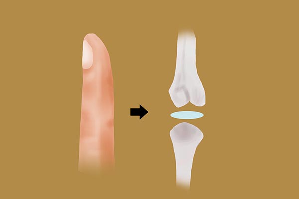 运动时肩膀关节咔咔响怎么回事,运动中膝盖关节咔咔响是什么原因