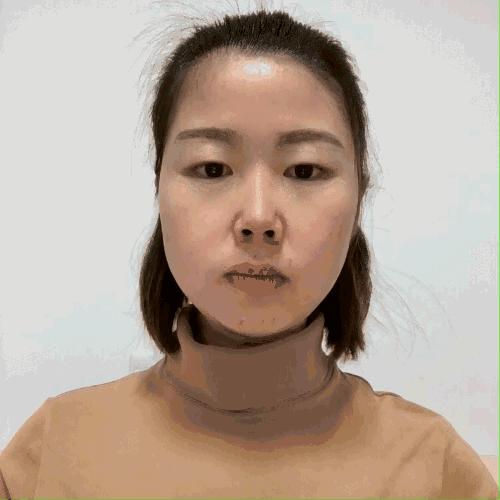 居家隔离怎么练基本功,面瘫初期自救方法