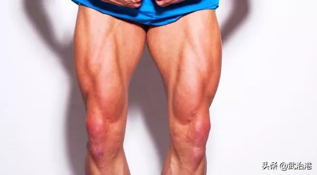 腰椎间盘突出全国有多少人,腰椎间盘突出别担心90%都能恢复