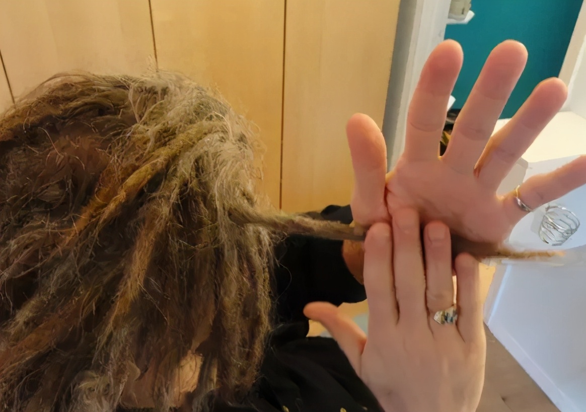 得了狐臭的原因是什么,造成狐臭的原因是什么