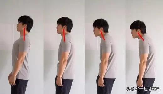 驼背如何矫正最快最有效方法,驼背怎么办最有效的方法