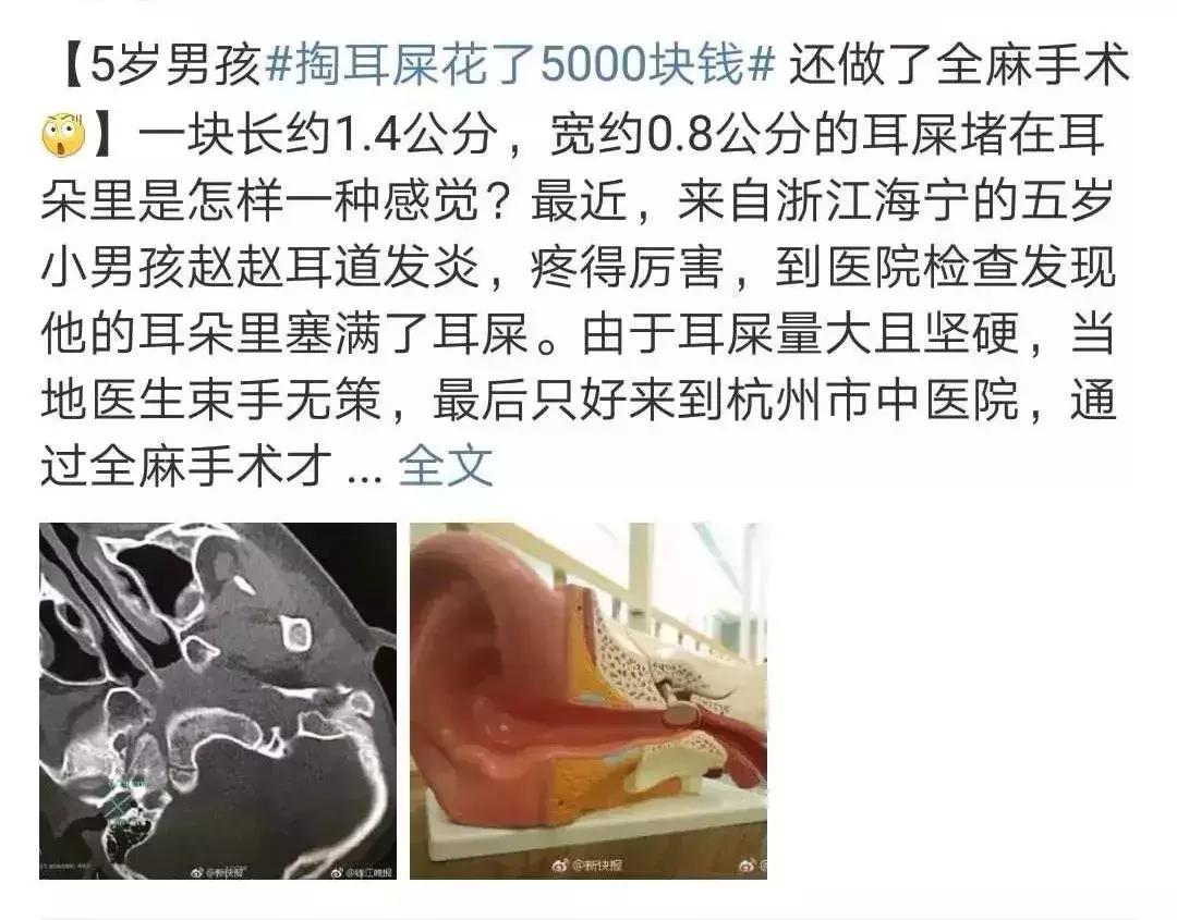 用棉签给宝宝掏耳朵,用棉签给宝宝清理外耳道