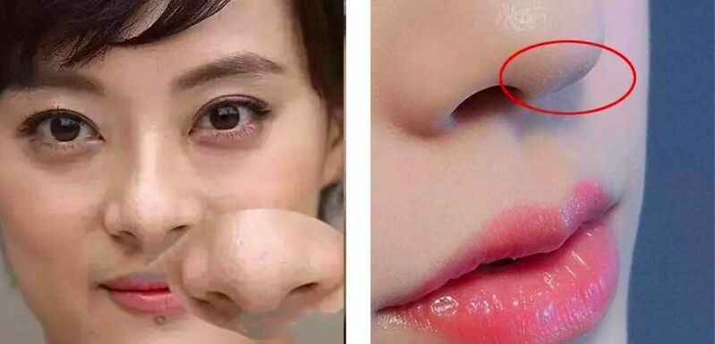 赵丽颖皮肤毛孔粗大图片,赵丽颖无美颜无滤镜最真实的模样