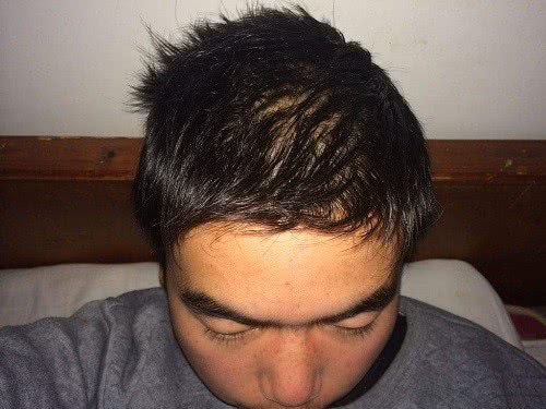 适合头发稀少的发型男生,头发稀少男生怎么弄