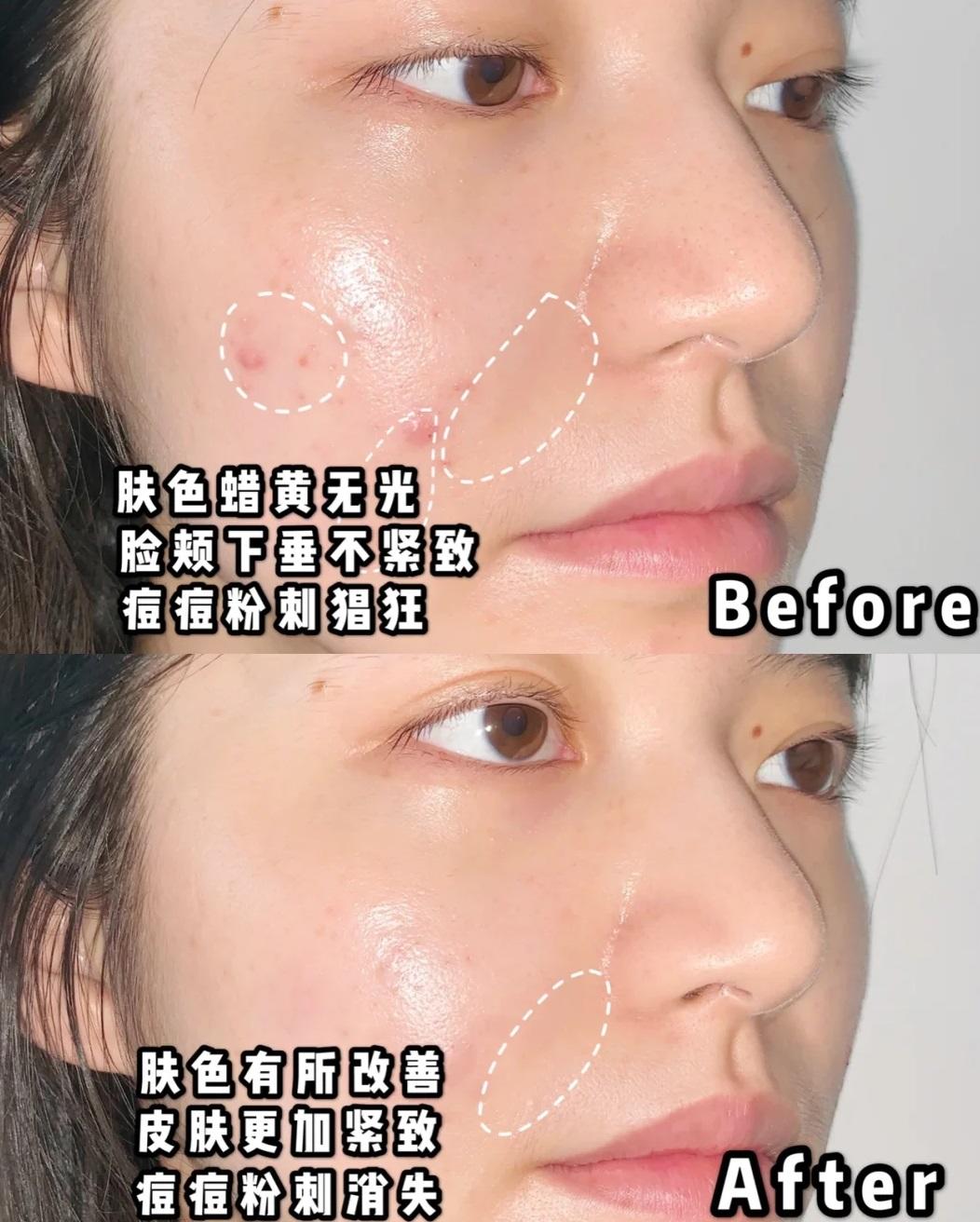 兰蔻美肌护肤方法,打造无瑕肌肤的食疗方法