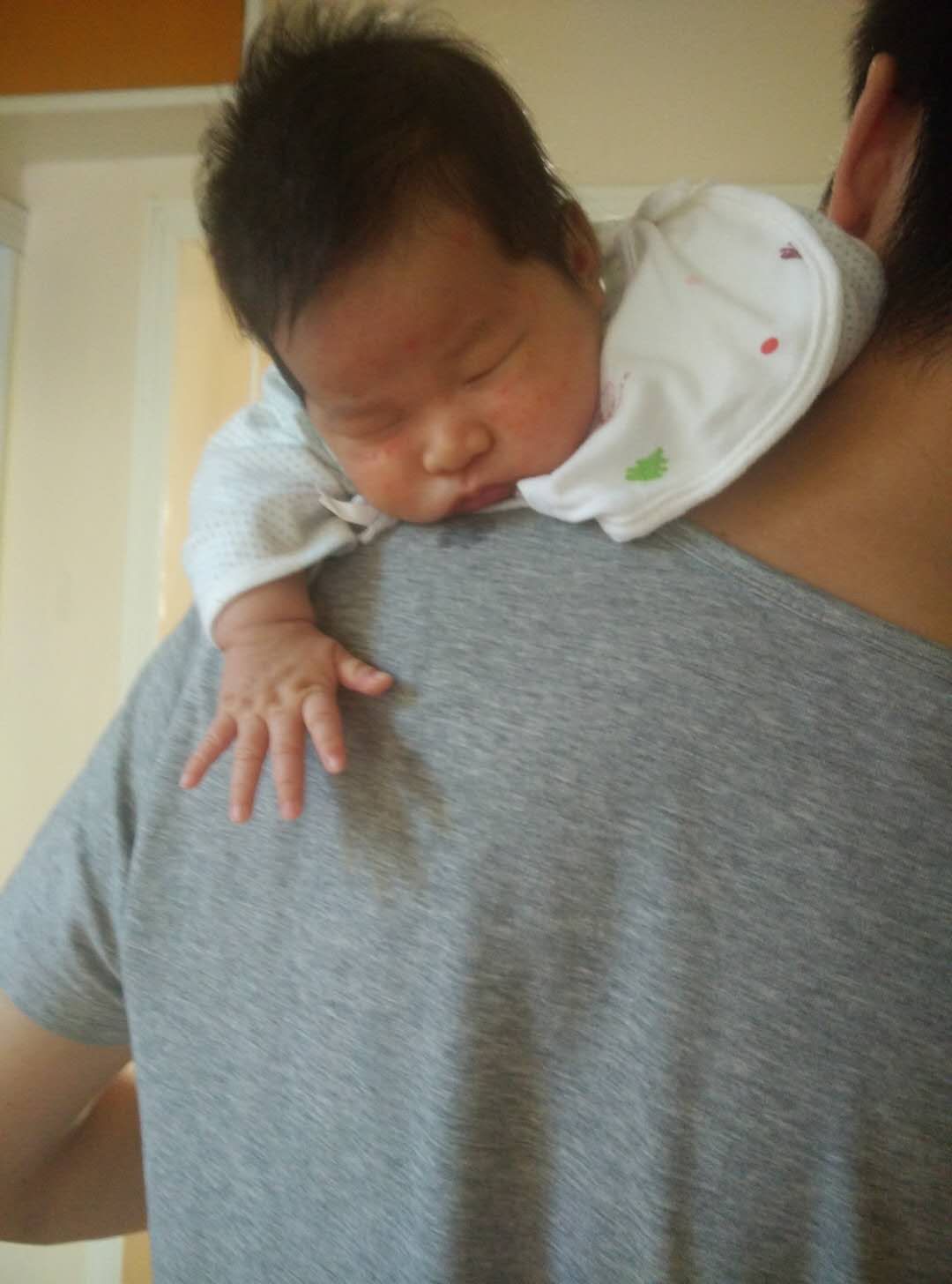 宝宝湿疹好不了?激素、抗生素怎么涂才安全有效?