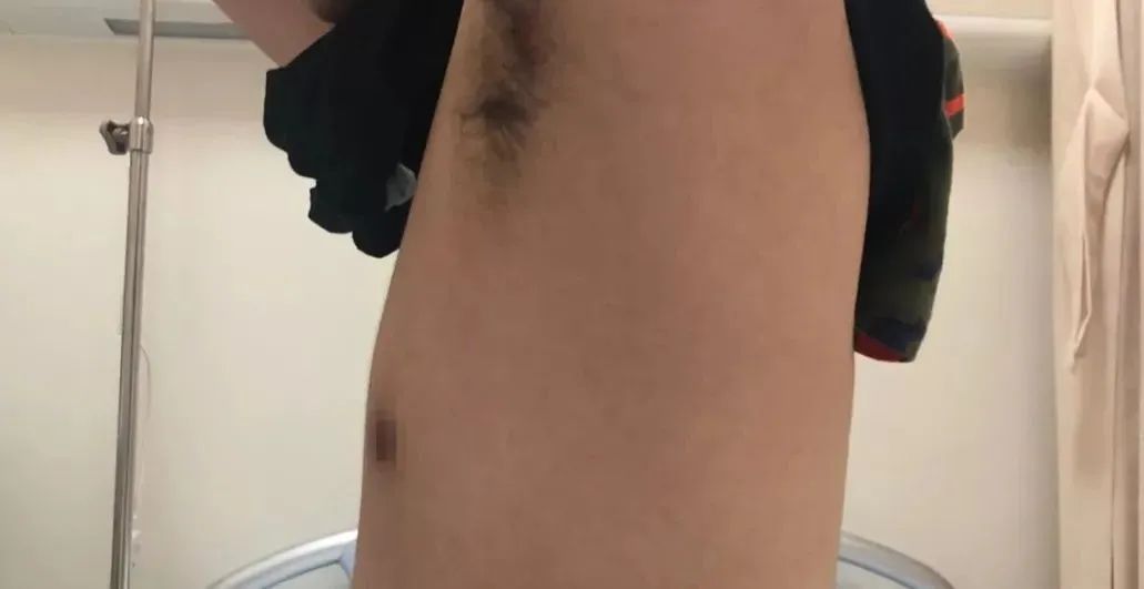 年轻女孩脸上长出离奇植物,18岁离奇怪病女孩