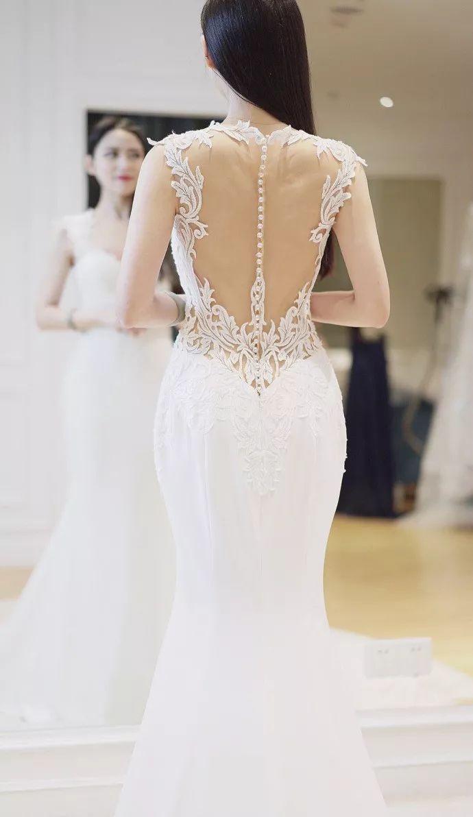 龅牙矫正前后对比照片,龅牙修复效果图