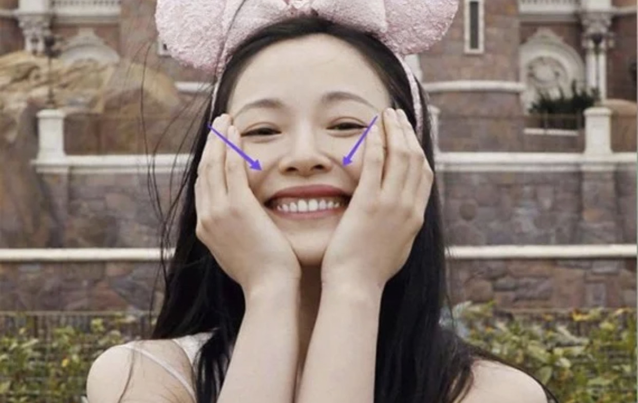 面无表情和爱笑哪个容易长皱纹,一笑眼下有皱纹怎么办