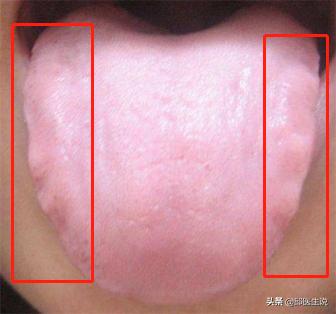 怎么感觉自己哪哪都虚,总感觉自己很虚要怎么调理