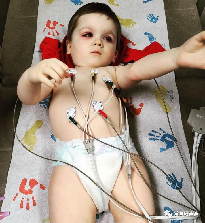 蠢萌蠢萌的洗澡鸭，差点让我儿子失去了一只眼