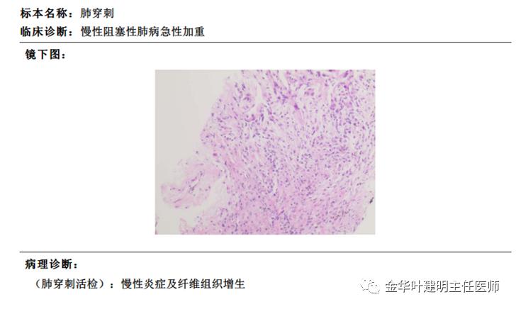 左肺占位被安排穿刺活检是肺癌吗,肺癌肺部穿刺有什么危险