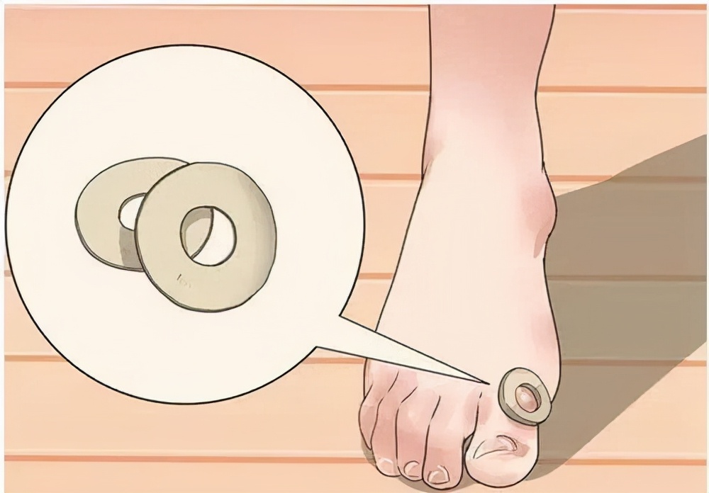 脚上长鸡眼了怎么才能去掉,脚上长鸡眼民间有什么说法