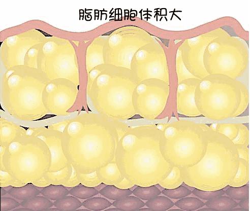 吸脂应该知道的秘密,面部吸脂真实经历视频