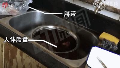 浜轰綋鑳庣洏淇℃伅,浜轰綋鑳庣洏鏄湡鐨勫悧