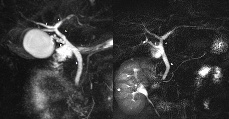 胆道系统解剖生理讲课视频,超声胆道系统的解剖生理