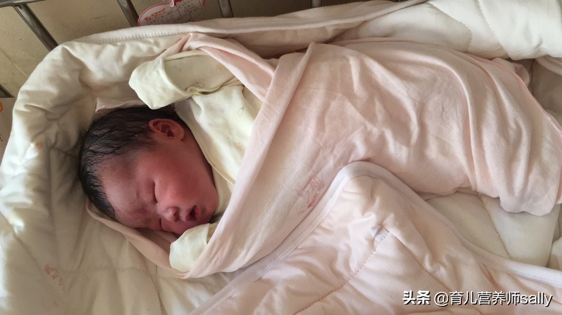 盆底检查有必要做吗,剖宫产要做盆底肌修复吗