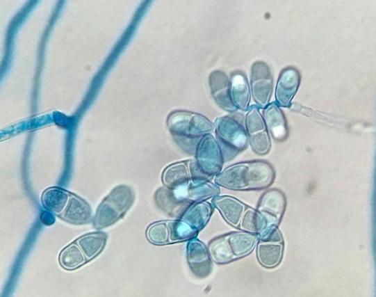 菠萝蜜锈斑病原因,菠萝蜜红粉病特效药