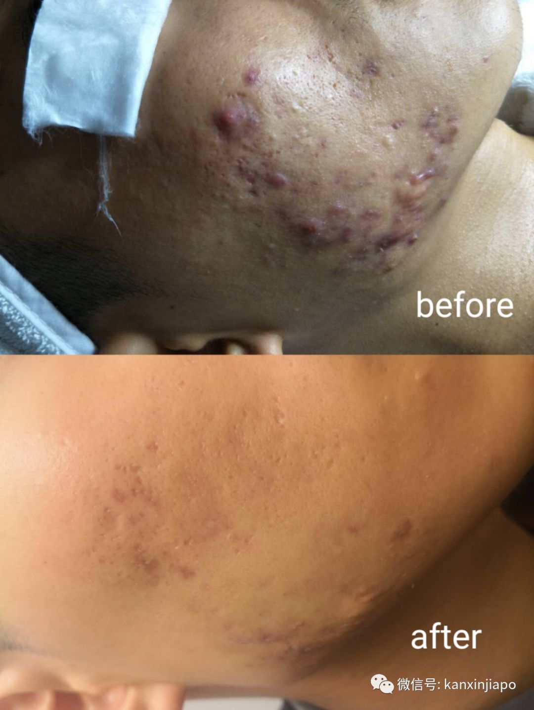 每周一次精准有效的皮肤管理,选对护肤方法让你做靓丽女神