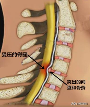 乳腺微创手术和开放手术的区别,开放手术和微创手术的区别