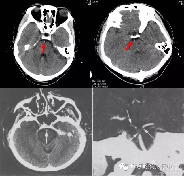 神经系统解剖及定位诊断视频,神经系统影像解析