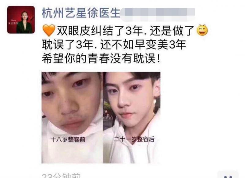杭州小伙整容,整容被医院侵权的杭州小哥