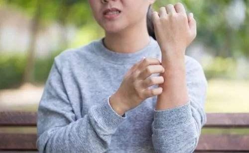 艾灸过后起水泡瘙痒是怎么回事,皮肤止不住瘙痒