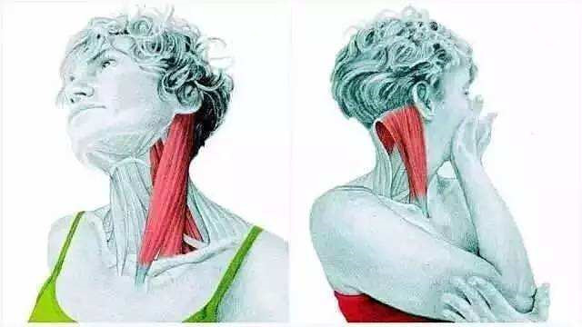 胸锁乳突肌疼可以艾灸吗,胸锁乳突肌的穴位总结