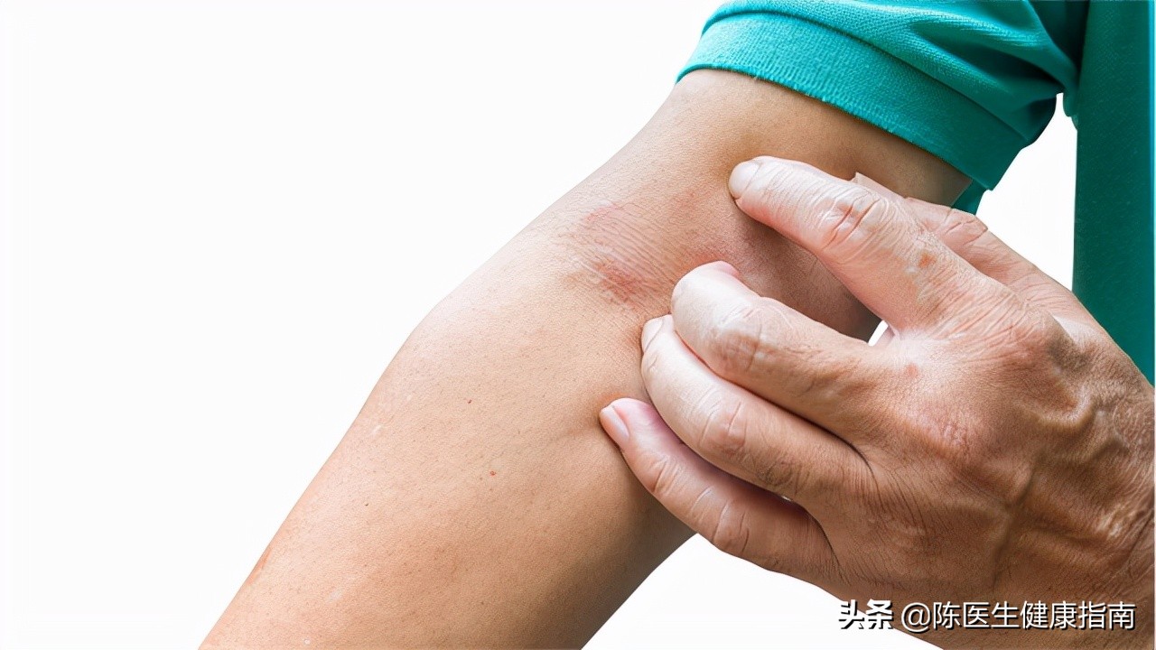 一级致癌物石棉瓦的危害有多大,一级致癌物质石棉长什么样