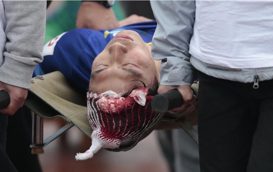 大连球员朱挺近况,大连足球朱挺一共进了多少球