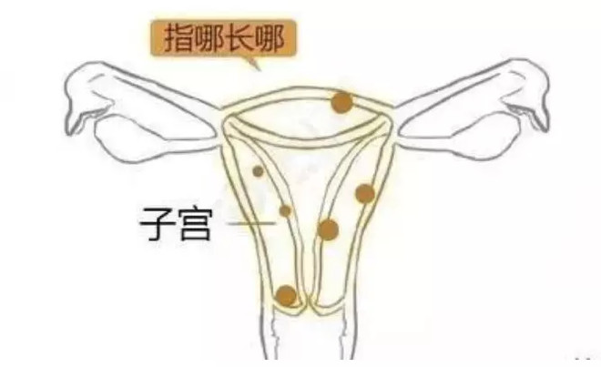 好文收藏|得了妇科病，还能买保险吗？