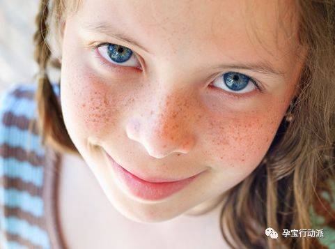 孕期长斑,变“黑妞”了怎么办