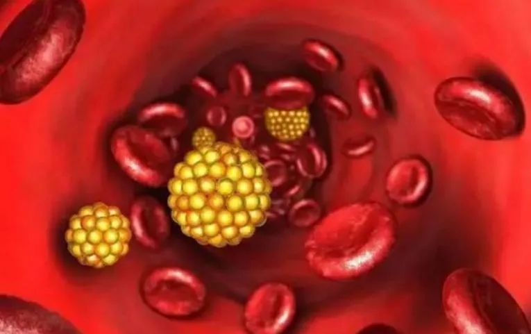 高脂血症有什么症状和危害,高脂血症的危害与防治