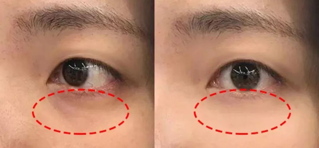 刘亦菲早期仙气照,刘亦菲仙姿玉色美到窒息